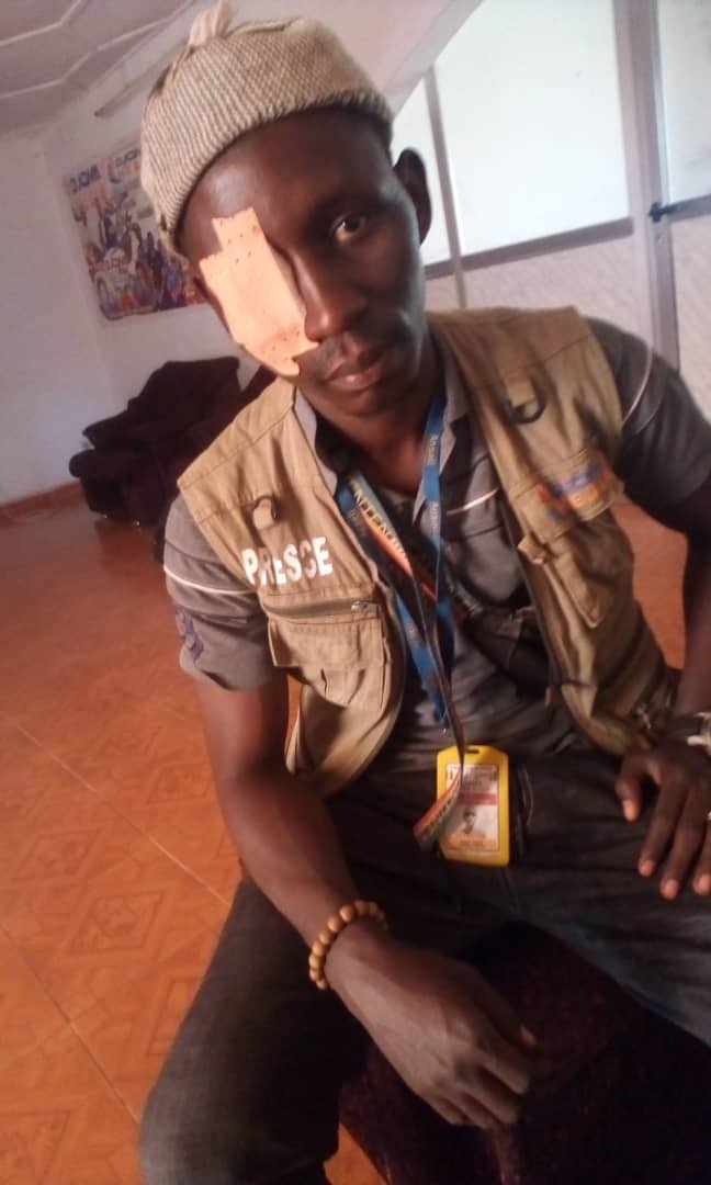 Siguiri, un journaliste agressé et battu par la police: le SPPG condamne cette barbarie.